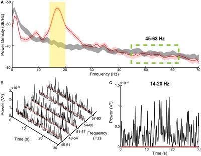 Differential Effects of Pathological Beta Burst Dynamics Between Parkinson’s Disease Phenotypes Across Different Movements